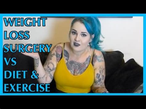 cactus weight loss surgery vs diet and exercise